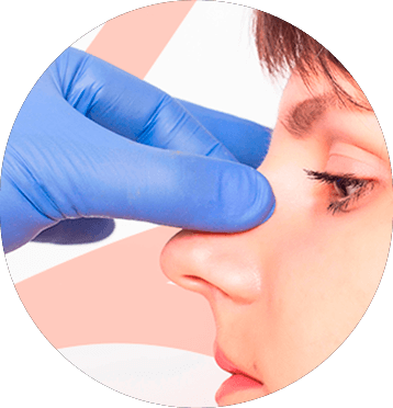 michelle-figueiredo-face-lifting-elipse