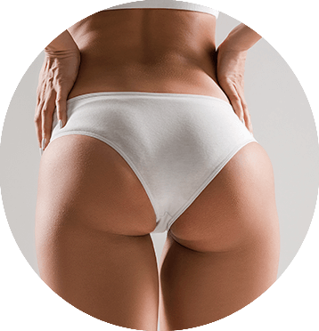 michelle-figueiredo-abdominoplastia-elipse