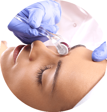 michelle-figueiredo-microagulhamento-elipse