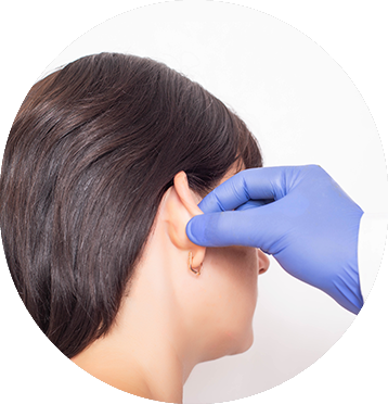 michelle-figueiredo-face-lifting-elipse